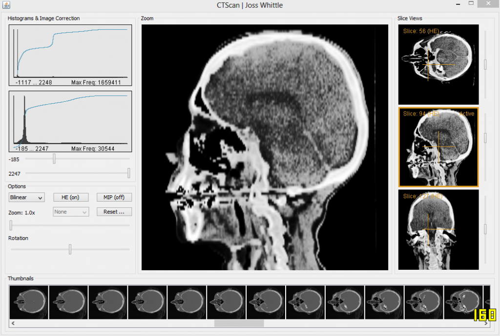 2nd year CT Scan coursework